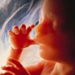 250foetus.jpg