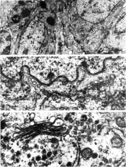 28_ganglions_cerebroides_pl_33.jpg_pl33-1.jpg