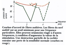 Figure08-Fibres-auditives-450.jpg