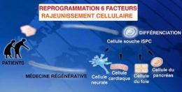 Montpellier - laboratoire INSERM -02_ Système de traitement 