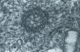 gonade_eclosion_centriole_10-1.jpg