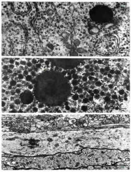 29_ganglions_cerebroides_pl_34.jpg