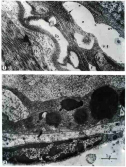 2_paroi du tubule gonadique_pl_2.jpg