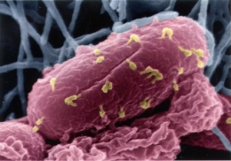 bactéries,résistance aux antibiotiques,nouvaus antibiotiques,nanomédicaments,phagothérapie,bactériophes,antibiotiques intelligents,éligobitiques,biofilms