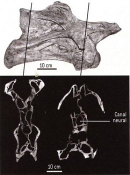 6_Vertebres_cervicales-1.jpg