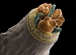 national geographic,jannicke wiik-nielsen,microscopie électronique à balayage