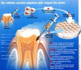 odontologie,cellules souches