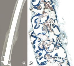 cellules souches,cellules souches adultes induites,cellules souches embryonnaires,ectoderme,endoderme,mésoderme,œuf,cellules germinales,gonocytes,cellule totipotente,cellule souche embryonnaire,cellule souche adulte,cellule souche multipotente,pluripotent stem cells,pst,cellules souches pluripotentes induites,ipsc,hesc