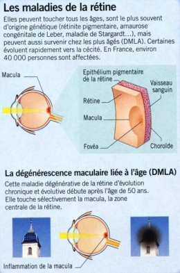 cellules souches,cellules souches embryonnaires,médecine régénératrice,rétine,thérapie