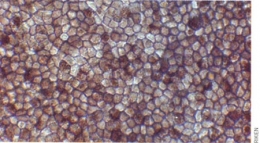 cellules souches embryonnaires,rétine,culture organotypique,macula,dmla,rétinopathie pigmentaire,glaucome,prothèse rétinienne