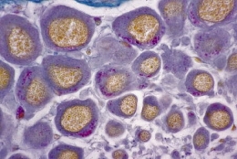 gc_neurosecretion_pl32_411.jpg