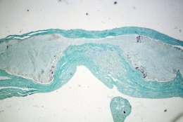 ganglions-cerebroides-381.jpg