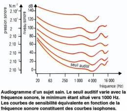 Figure02-audiogramme-450.jpg