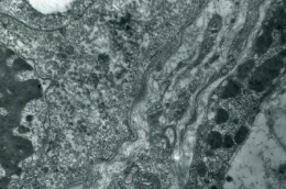 cellule-souche-basale-me321.jpg