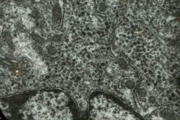 gc_neurosecretion_pl32_441.jpg