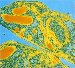 le monde,paludisme,plasmodium,anophèle,burkina faso,éradication,lâcher de moustiques mâles