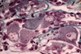 Ovotestis+uter_pal_0091.jpg