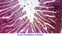 5-Coupe-histologique-d'intestin-200.jpg