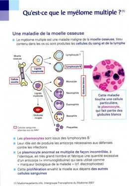 Myélome-multiple_002-450.jpg