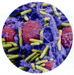 bactéries,résistance aux antibiotiques,nouvaus antibiotiques,nanomédicaments,phagothérapie,bactériophes,antibiotiques intelligents,éligobitiques,biofilms