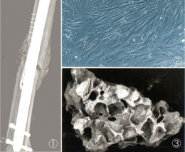 cellules souches,cellules souches adultes induites,cellules souches embryonnaires,ectoderme,endoderme,mésoderme,œuf,cellules germinales,gonocytes,cellule totipotente,cellule souche embryonnaire,cellule souche adulte,cellule souche multipotente,pluripotent stem cells,pst,cellules souches pluripotentes induites,ipsc,hesc