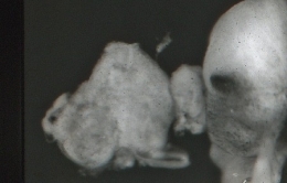 5_culture_gonade_tentacule_cerveau_pl_43-551.jpg