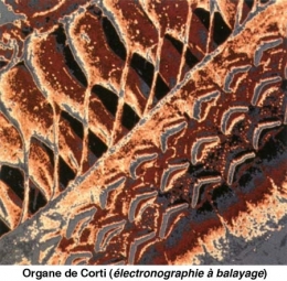 Organe-de-Corti-450.jpg