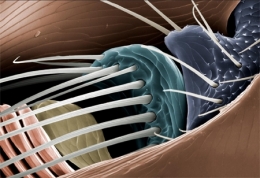 national geographic,jannicke wiik-nielsen,microscopie électronique à balayage