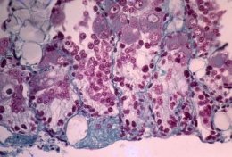 Ovotestis+testPal_0211.jpg