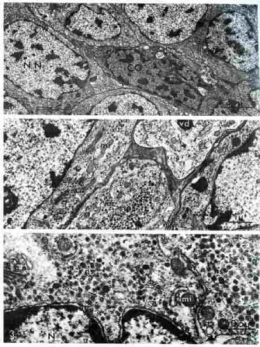 30_ganglion_tentaculaire_pl_35.jpg