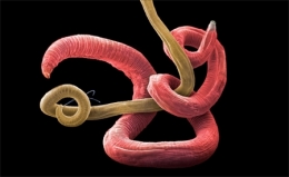 national geographic,jannicke wiik-nielsen,microscopie électronique à balayage