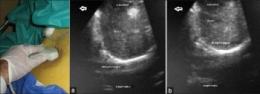 EchoAirway 3.jpg