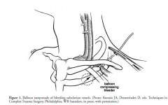 Foley Sous Clav.JPG