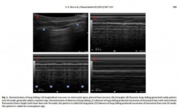 Echo Airway 2.jpg