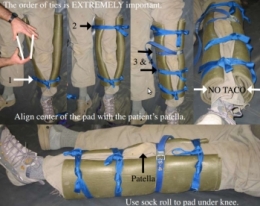 ImmobilisationTapisSol.jpg