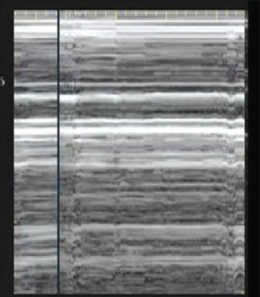 Pneumothorax_Images PasNormales1.jpg