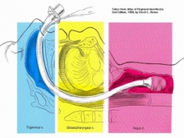 AirwayPicture1.jpg