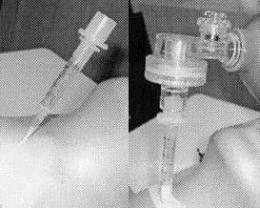 CatheterOverNeedle.JPG