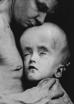 TCHERNOBYL ENFANTS 6.jpg