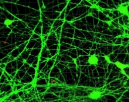 cerveau,sciences,biologie,médecine,virus,adn