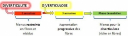 diverticulite et diverticulose