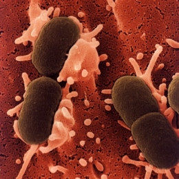 escherichia_coli.jpg