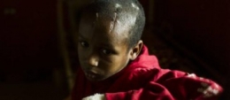Cet enfant blessé à la tête par un coup de machette "résume, à lui seul, ce qu'on fait à son peuple tout entier", écrit le photographe sur le blog de l'AFP.