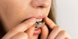 traitement malocclusion.jpg