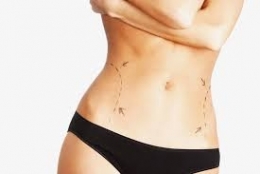 liposuccion abdomen.jpg